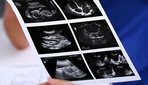 srp-insights-carousel-mobile-500x550-High-performance-print-media